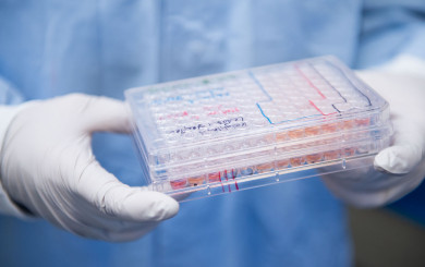 Box with eyecup cell cultures held by a ProQR laboratory technician