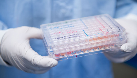 Box with eyecup cell cultures held by a ProQR laboratory technician