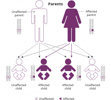 Infographic describing autosomal dominant retinitis pigmentosa inheritance. One of two parents at the top of the graph has RP carrying one mutated gene and one normal gene. The other parent is unaffected with two normal copies of the gene. Of their four children at the bottom of the graph two have one mutated gene and have RP (50% chance), two are unaffected with two normal copies of the gene (50% chance).