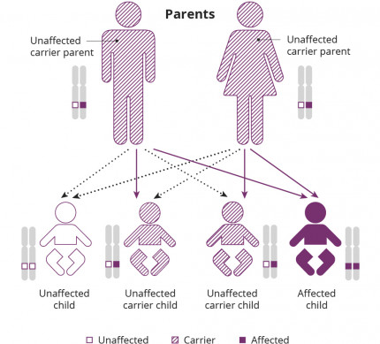 Infographic describing autosomal recessive retinitis pigmentosa inheritance. The two parents at the top of the graph do not have RP, but each carry one copy of the RP gene and one normal copy. They are carriers of RP. Of their four children at the bottom of the graph one inherited two mutated genes and is affected by the condition (25% chance), two are unaffected carriers with one mutated and one normal gene (50% chance) and one has two normal genes (25% chance).
