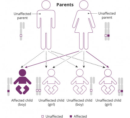 Retinitis Pigmentosa An Inherited Retinal Disease Causing Blindness