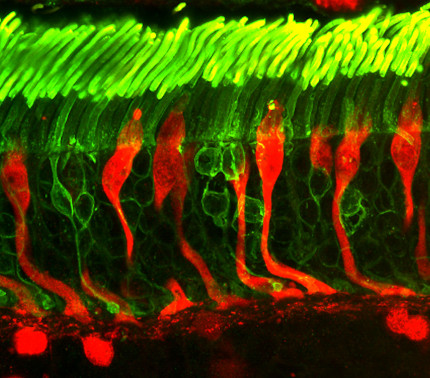 Microscope image of rods and cones photoreceptors in a human retina