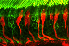 Microscope image of rods and cones photoreceptors in a human retina