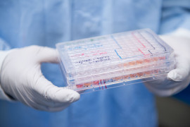 Box with eyecup cell cultures held by a ProQR laboratory technician